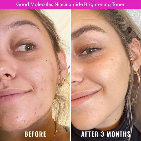 Good Molecules Niacinamide Brightening Face Toner - 1 fl oz