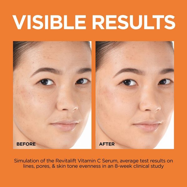 L'Oreal Paris Revitalift 12% Vitamin C + E + Salicylic Serum - 1 fl oz