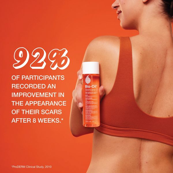 Bio-Oil Skincare Body Oil and Scar Treatment with Vitamin E for Stretch Marks, Acne Spots, Massage and Cuticle Care - 6.7 fl oz