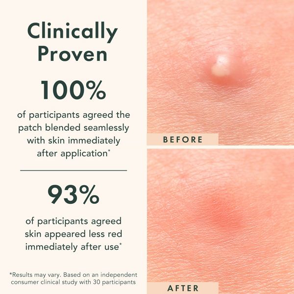 Rael Beauty Miracle Pimple Patch Invisible Spot Cover for Acne - 24ct