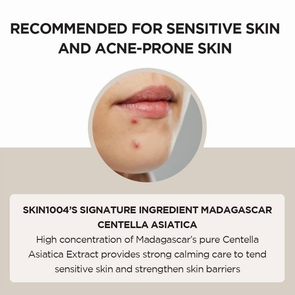 SKIN1004 Madagascar Centella Ampoule Korean Skincare for Soothing and Healing Sensitive Skin - 55ml