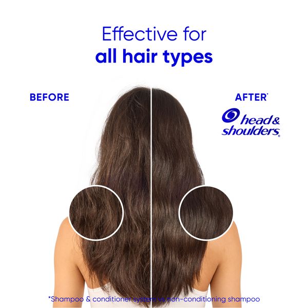 Head & Shoulders Shampoos and Conditioner