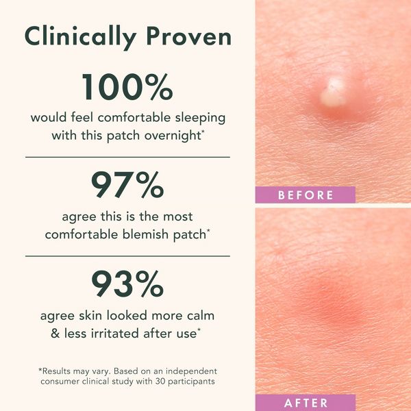 Rael Beauty Miracle Pimple Patch Overnight Spot Cover for Acne - 26ct