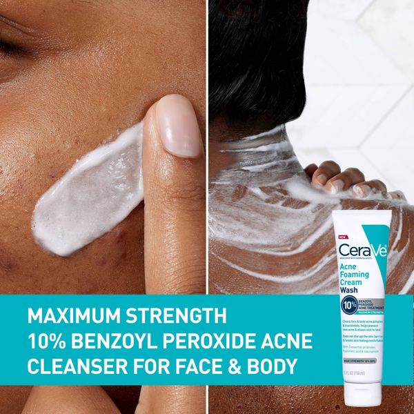 CeraVe Acne Control Foaming Face Cleanser 10% BPO - 5 fl oz