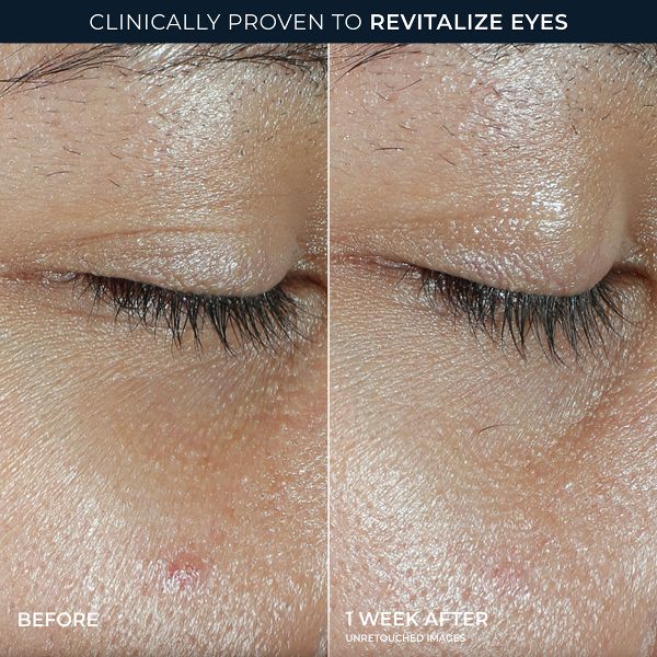 RoC Multi Correxion Revive and Glow Vitamin C Under Eye Balm - 0.14oz