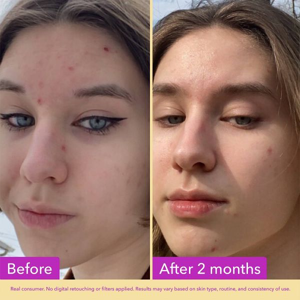 Good Molecules Niacinamide Serum - 75ml