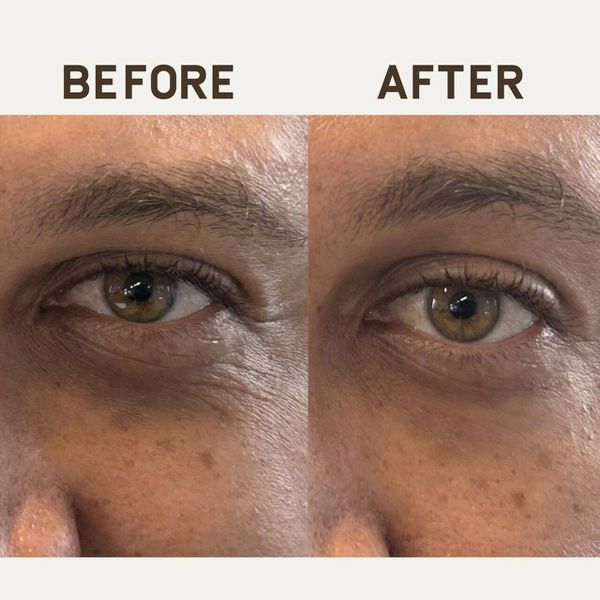 Papatui Men's Paraben-Free Niacinamide, Hyaluronic Acid and Caffeine Under Eye Patches - Unscented - 1 Pair
