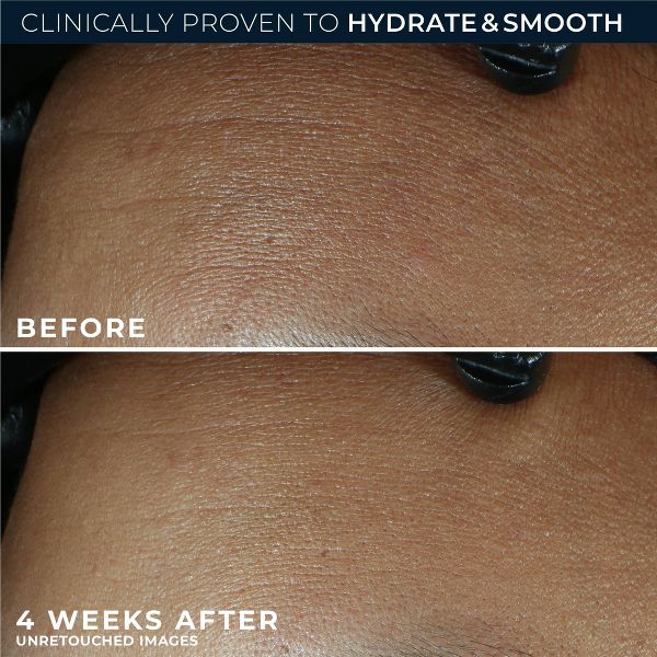 RoC Retinol Correxion Line Smoothing Max Hydration Cream - 1.7oz