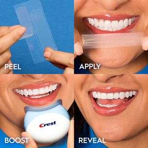 Crest 3D Whitestrips Professional White with Light Teeth Whitening Kit - 19 Treatments