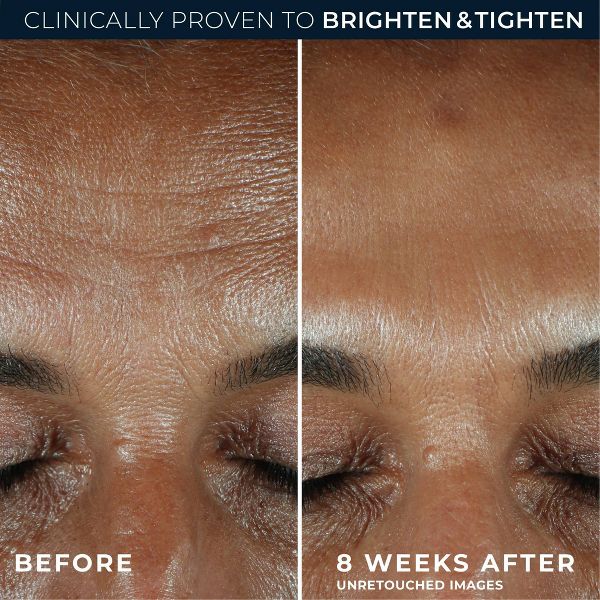 RoC Brightening Anti-Aging Serum with Vitamin C for Dark Spots - 1.0 fl oz