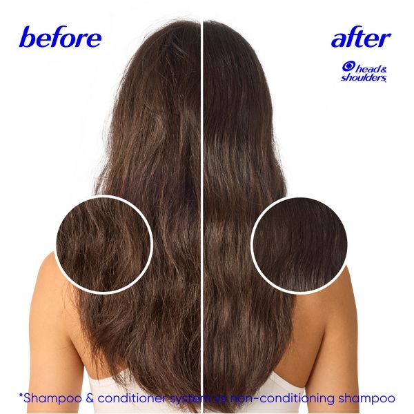 Head & Shoulders Dry Scalp Care 2-in-1 Anti-Dandruff Shampoo and Conditioner with Almond Oil - 28.2 fl oz