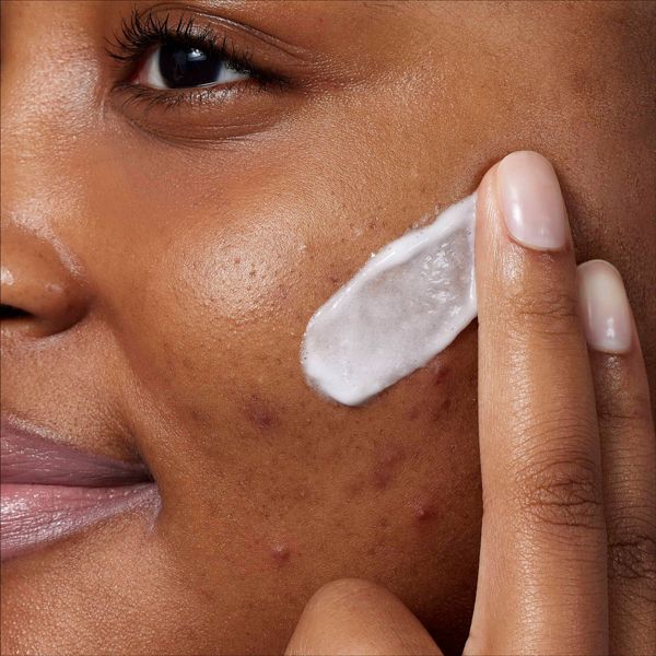 CeraVe Acne Control Foaming Face Cleanser 10% BPO - 5 fl oz