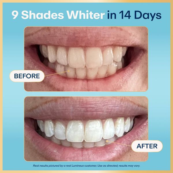 Lumineux Tooth Whitening Strips - 7ct