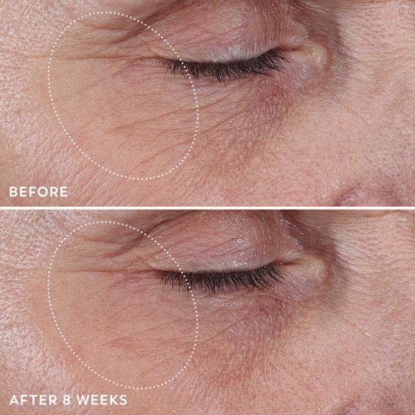 Olay Regenerist Anti-Aging Eye Wrinkle Treatment, Firming & Hydrating - 0.68 fl oz